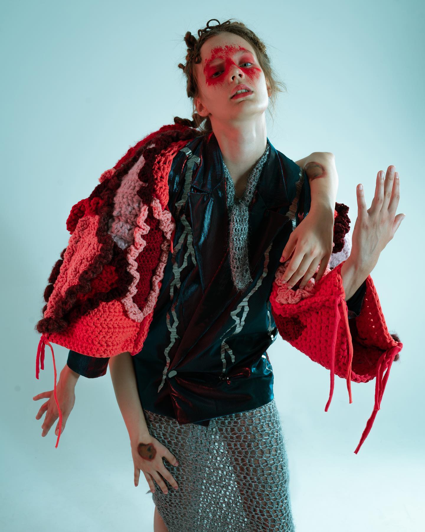 ELECTRIC INJURY — Look 3