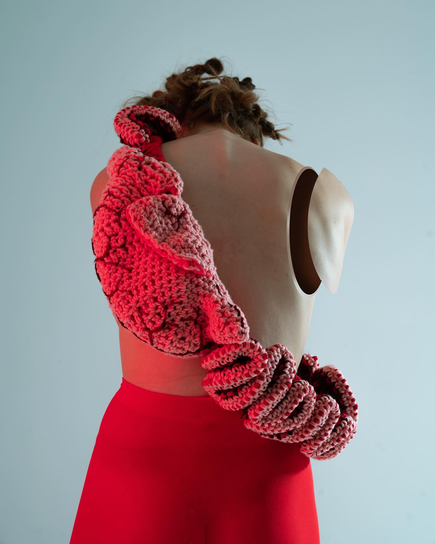 ELECTRIC INJURY — Look 5