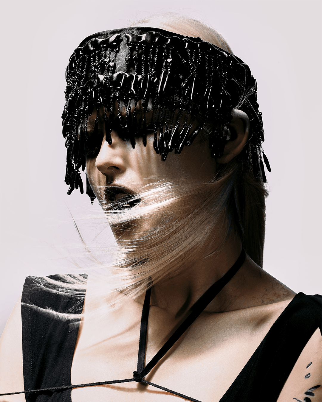 Anemia — Look 4