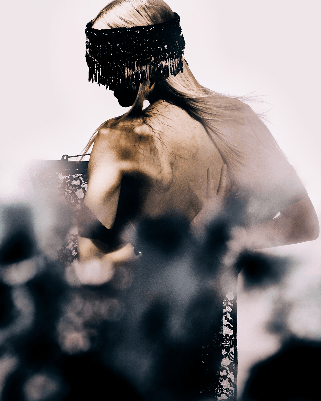 Anemia — Look 5