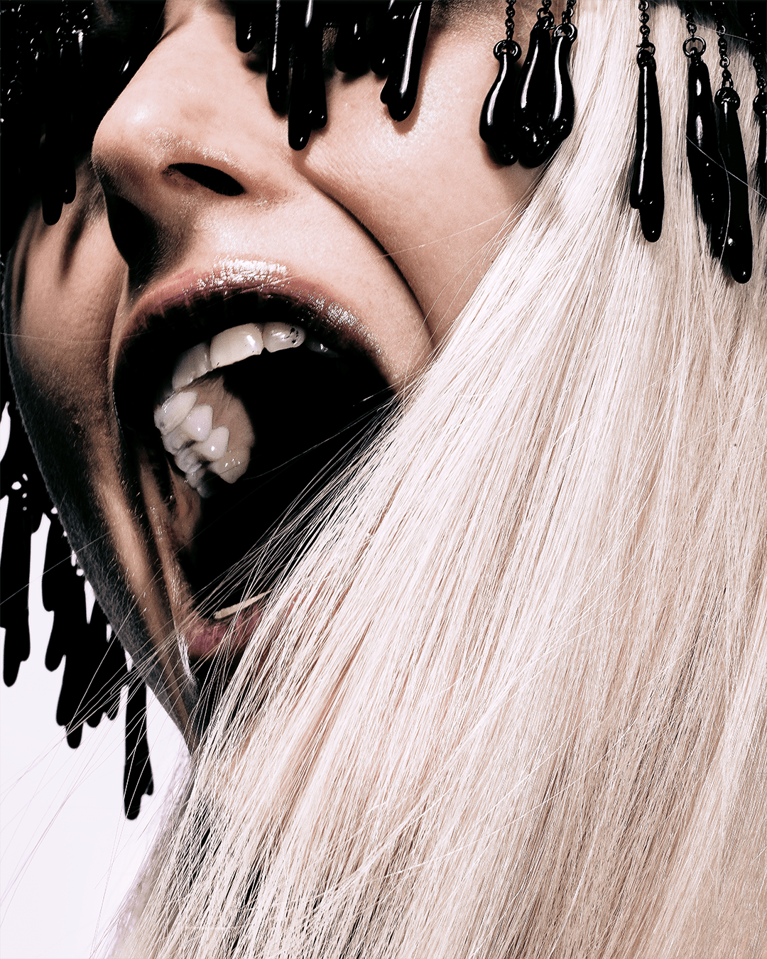 Anemia — Look 6